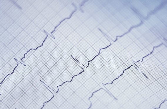 심전도검사 (EKG)