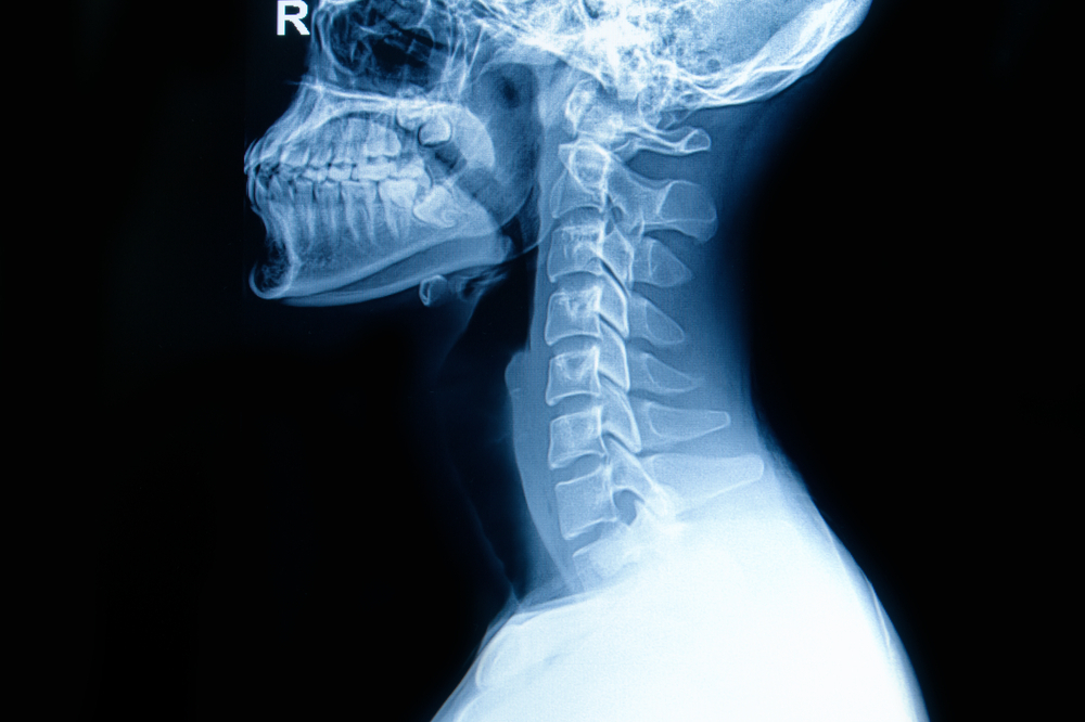 X-Ray 검사